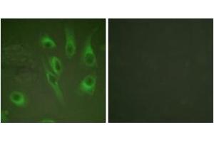 Immunofluorescence analysis of HeLa cells, using Calnexin (Phospho-Ser583) Antibody. (Calnexin anticorps  (pSer583))
