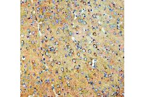 IHC analysis of SEC22B using anti-SEC22B antibody (ABIN7602121).