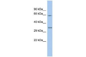 MIF4GD antibody used at 1 ug/ml to detect target protein. (MIF4GD anticorps  (N-Term))