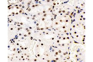 Immunohistochemistry analysis of paraffin-embedded Rat kidney using S100A4 Polyclonal Antibody at dilution of 1:400. (s100a4 anticorps)