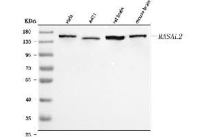 Western blot analysis of RASAL2 using anti-RASAL2 antibody (ABIN7602198).