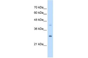 WB Suggested Anti-CACYBP Antibody Titration:  5. (CACYBP anticorps  (Middle Region))