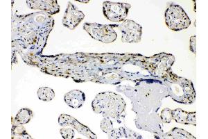 AKR1B1 was detected in paraffin-embedded sections of human placenta tissues using rabbit anti- AKR1B1 Antigen Affinity purified polyclonal antibody (Catalog # ) at 1 ?