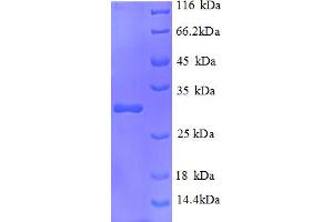 SDS-PAGE (SDS) image for Interleukin 2 Receptor, beta (IL2RB) (AA 24-240), (Extracellular) protein (His tag) (ABIN5709743)