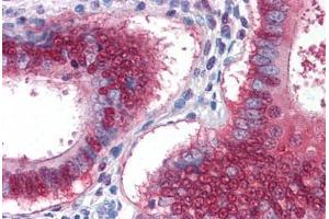 Human Uterus: Formalin-Fixed, Paraffin-Embedded (FFPE) (YAP1 anticorps  (AA 53-162))