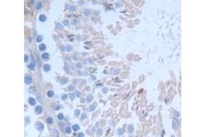 Figure. (Selenoprotein W anticorps  (AA 1-86))