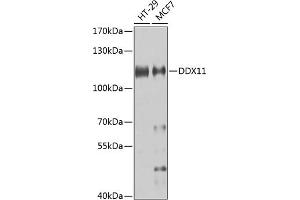 Western blot analysis of extracts of various cell lines, using DDX11 antibody (ABIN6130249, ABIN6139479, ABIN6139480 and ABIN6223588) at 1:1000 dilution. (DDX11 anticorps  (AA 1-220))