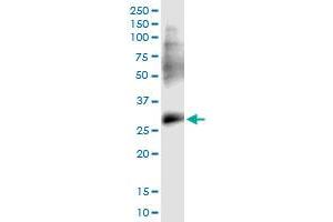 anti-Protein Phosphatase 1, Regulatory (Inhibitor) Subunit 2 Pseudogene 3 (PPP1R2P3) (AA 1-205) antibody