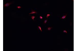 ABIN6268885 staining A-431 cells by IF/ICC.