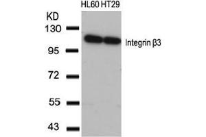 Image no. 3 for anti-Integrin beta 3 (ITGB3) (AA 771-775) antibody (ABIN197246) (Integrin beta 3 anticorps  (AA 771-775))