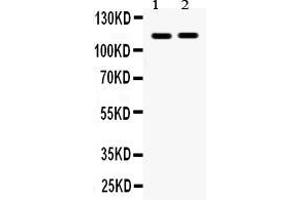 Anti- Eph receptor A5 Picoband antibody, Western blottingAll lanes: Anti Eph receptor A5  at 0. (EPH Receptor A5 anticorps  (C-Term))