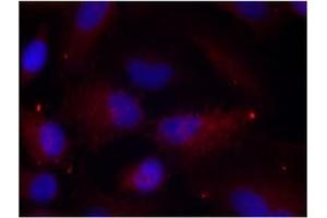 Image no. 1 for anti-P21-Activated Kinase 1 (PAK1) (pThr402), (pThr421), (pThr423) antibody (ABIN196896) (PAK1 anticorps  (pThr402, pThr421, pThr423))