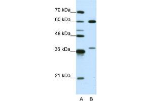 WB Suggested Anti-HNRPL Antibody Titration:  0. (HNRNPL anticorps  (N-Term))