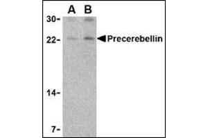Image no. 4 for anti-Cerebellin 1 Precursor (CBLN1) (Middle Region) antibody (ABIN303204)