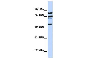 Western Blotting (WB) image for anti-Protein Phosphatase 4, Regulatory Subunit 2 (PPP4R2) antibody (ABIN2458684) (PPP4R2 anticorps)