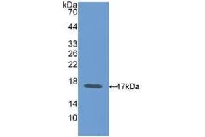 Detection of Recombinant CEA, Mouse using Polyclonal Antibody to Carcinoembryonic Antigen (CEA) (CEA anticorps  (AA 85-222))