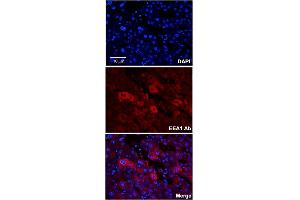 Immunofluorescent staining of human adult liver with EEA1 polyclonal antibody  at 1:100 dilution. (EEA1 anticorps  (N-Term))