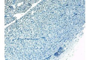 ABIN185584 Negative Control showing staining of paraffin embedded Human Heart, with no primary antibody.