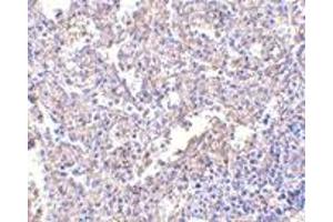 Immunohistochemistry (IHC) image for anti-Lymphocyte Antigen 96 (LY96) antibody (ABIN1031731)