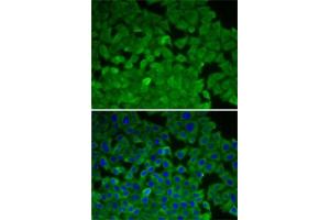 Immunofluorescence analysis of A-549 cells using EEF2K antibody (ABIN6130354, ABIN6139955, ABIN6139956 and ABIN7101771). (EEF2K anticorps  (AA 406-725))