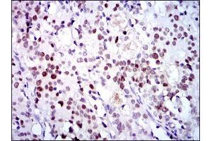 Immunohistochemistry (IHC) image for anti-Cyclin-Dependent Kinase 2 (CDK2) antibody (ABIN1845617) (CDK2 anticorps)