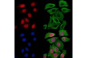 ABIN7094277 and ABIN7098324 staining Hela cells by IF/ICC. (HMBOX1 anticorps  (N-Term))