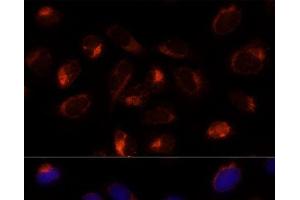 Immunofluorescence analysis of U-2 OS cells using TXNDC12 Polyclonal Antibody at dilution of 1:100 (40x lens). (TXNDC12 anticorps)