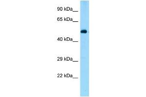 WB Suggested Anti-Zbtb44 Antibody Titration: 1. (ZBTB44 anticorps  (N-Term))