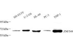 Western blot analysis of ZNF549 (ABIN7076267) at dilution of 1: 1000