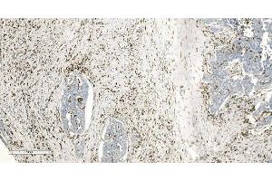 IHC analysis of Coronin 1a/TACO/CORO1A using anti-Coronin 1a/TACO/CORO1A antibody (ABIN7600292).