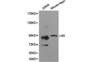 Western Blotting (WB) image for anti-Androgen Receptor (AR) antibody (ABIN1871059) (Androgen Receptor anticorps)