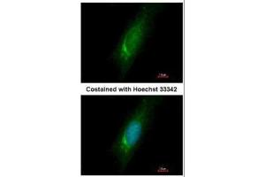 ICC/IF Image Immunofluorescence analysis of methanol-fixed HeLa, using Homer3, antibody at 1:500 dilution. (HOMER3 anticorps  (Center))