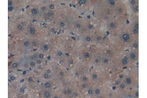 Detection of APOA2 in Human Liver Tissue using Polyclonal Antibody to Apolipoprotein A2 (APOA2)