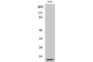 Western Blotting (WB) image for anti-Parathyroid Hormone (PTH) (Internal Region) antibody (ABIN3180837) (PTH anticorps  (Internal Region))