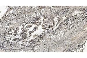 IHC analysis of HP1 alpha/CBX5 using anti-HP1 alpha/CBX5 antibody (ABIN7599057). (CBX5 anticorps  (AA 1-191))