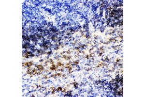 Anti- CD79B picoband antibody,IHC(P) IHC(P): Mouse Spleen Tissue