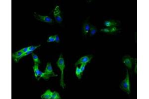 Immunofluorescence staining of Hela cells with ABIN7147325 at 1:100, counter-stained with DAPI. (MCAM anticorps  (AA 50-646))