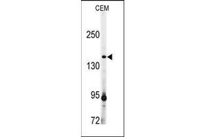 Western blot analysis: ADAMTS13 antibody staining of CEM cell line lysates (35 µg/lane). (ADAMTS13 anticorps  (AA 836-866))