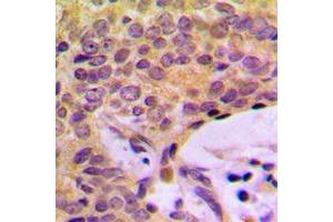 anti-ATP/GTP Binding Protein-Like 2 (AGBL2) (C-Term) antibody