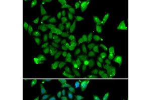 Immunofluorescence analysis of MCF-7 cells using ASPA Polyclonal Antibody (ASPA anticorps)