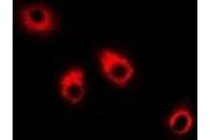 Immunofluorescent analysis of Eppin staining in HepG2 cells.