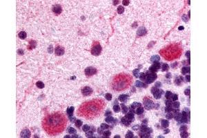 Anti-Kappa Opioid Receptor antibody IHC of rat brain, Purkinje neurons.