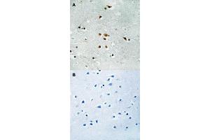Immunohistochemical staining (Formalin-fixed paraffin-embedded sections) of human brain tissue with FER (phospho Y402) polyclonal antibody  without blocking peptide (A) or preincubated with blocking peptide (B) under 1:50-1:100 dilution. (FER anticorps  (pTyr402))