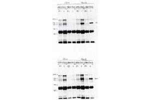 Image no. 1 for anti-Vav 2 Guanine Nucleotide Exchange Factor (VAV2) antibody (ABIN291773)
