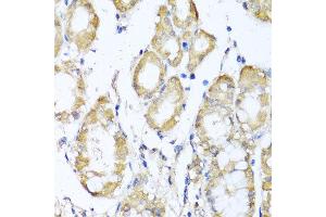 Immunohistochemistry of paraffin-embedded human stomach using KCND2 antibody at dilution of 1:100 (x40 lens).