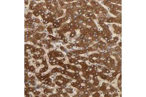 Immunohistochemical staining (Formalin-fixed paraffin-embedded sections) of human liver with PYGL polyclonal antibody  shows strong cytoplasmic positivity in hepatocytes.