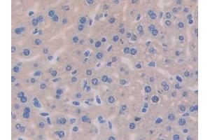 DAB staining on IHC-P; Samples: Mouse Liver Tissue