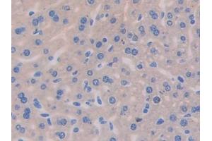 DAB staining on IHC-P; Samples: Mouse Liver Tissue (IL13 Receptor alpha 1 anticorps  (AA 201-360))