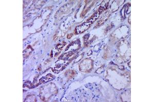 Paraformaldehyde-fixed, paraffin embedded human kidney, Antigen retrieval by boiling in sodium citrate buffer (pH6.