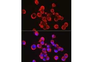 Immunofluorescence analysis of Neuro-2a cells using α-Synuclein Rabbit pAb (ABIN6129177, ABIN6148190, ABIN6148192 and ABIN6223046) at dilution of 1:100 (40x lens). (SNCA anticorps  (AA 61-140))
